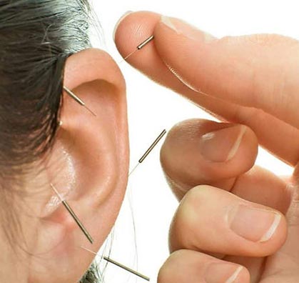 Ear acupuncture methods